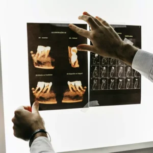 Radiografía Dental